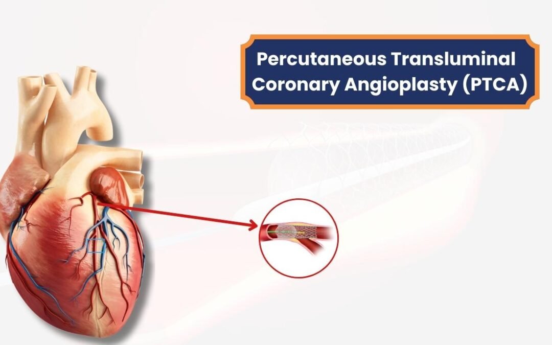 Coronary angioplasty in ambazari nagpur