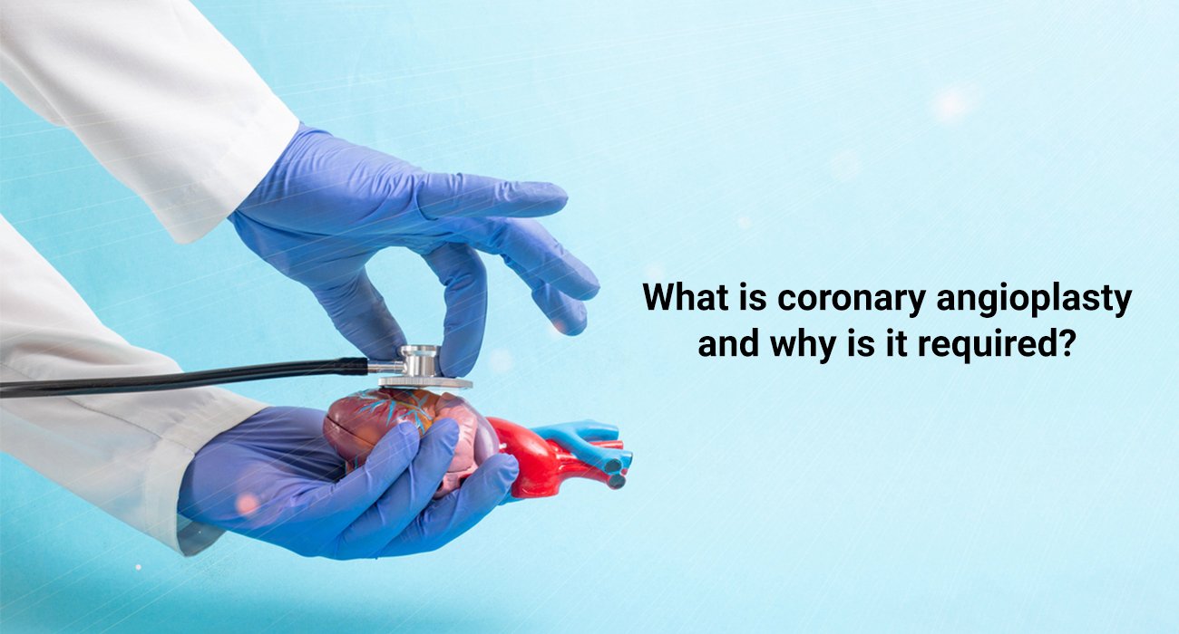 Coronary angioplasty in itwari nagpur