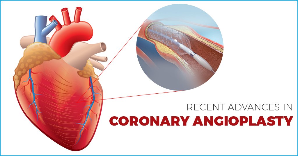 Coronary angioplasty in ram nagar nagpur