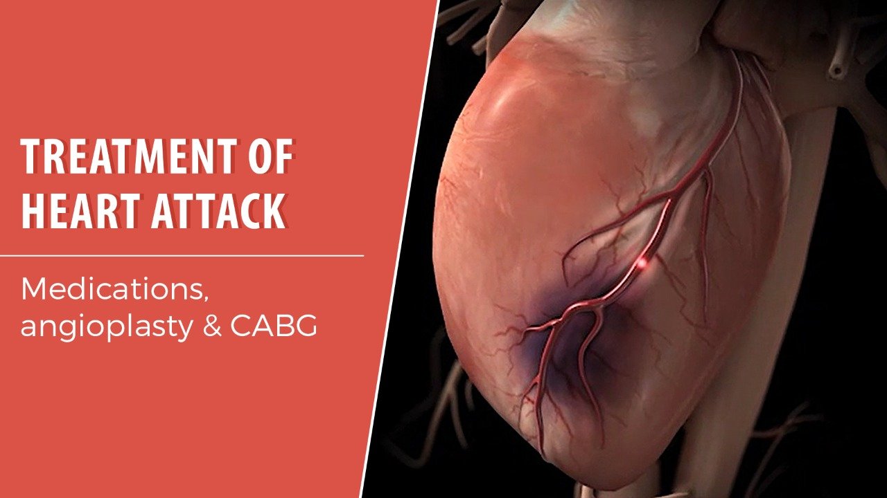 Heart attack treatment in ajni nagpur