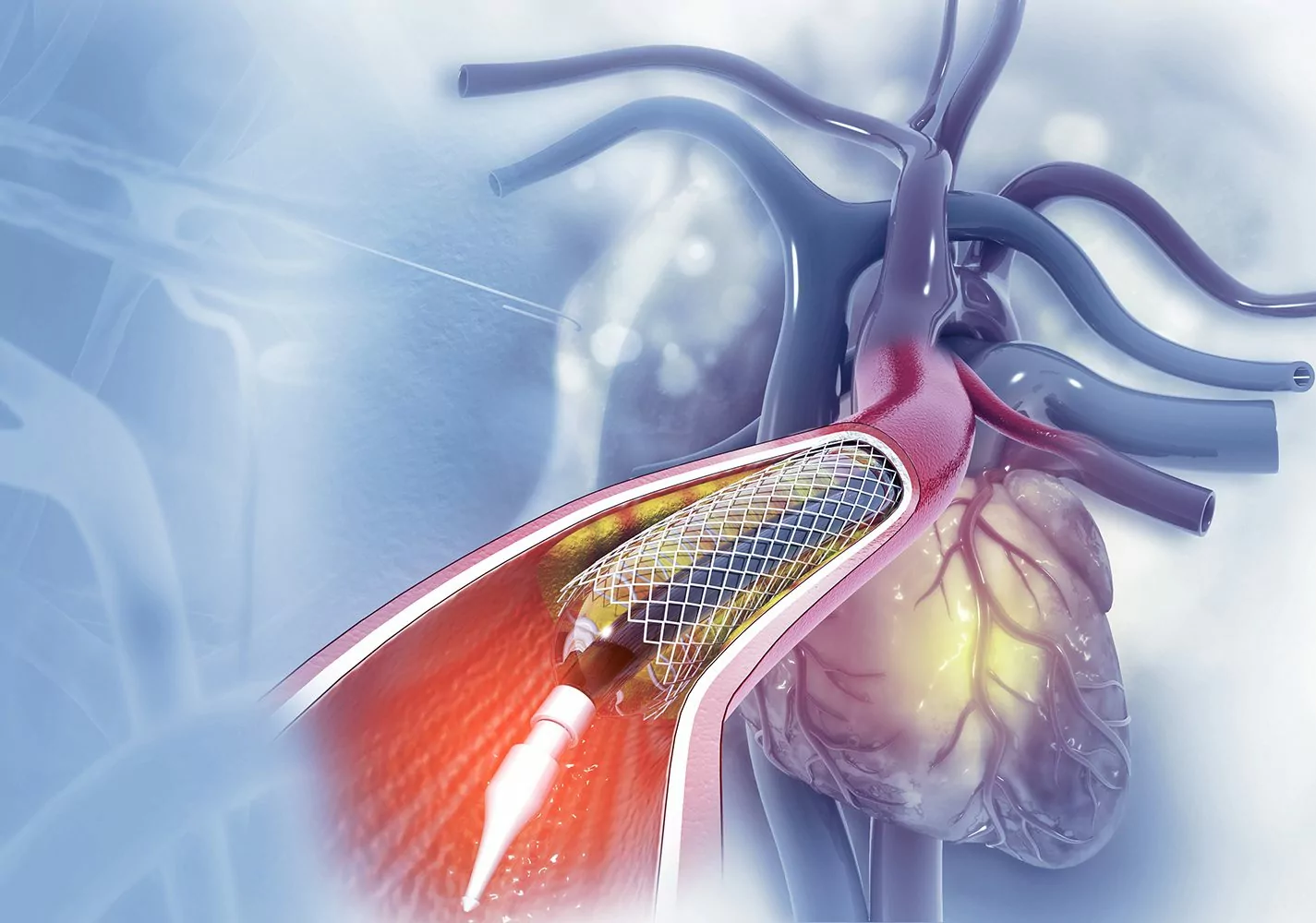 Interventional cardiologist in dhantoli nagpur