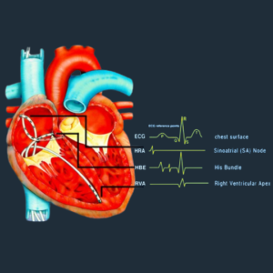 Top cardiac electrophysiologists in gondia