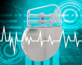 Top cardiac electrophysiologists in satna